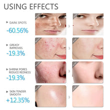 Load image into Gallery viewer, კორეული სახის მოვლის ნაკრები: სერუმი, გამწმენდი, ლოსიონი, ტონერი